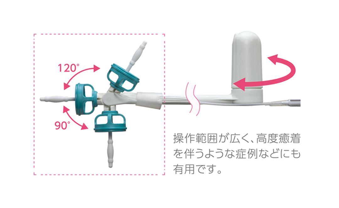 操作範囲が広く、高度癒着を伴うような症例などにも有用